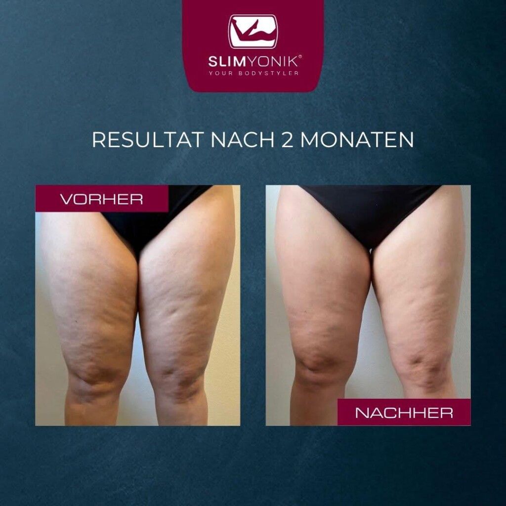 slimyonik resultate nach 2 monaten